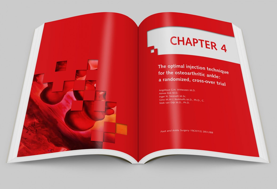 ankle osteoarthritis